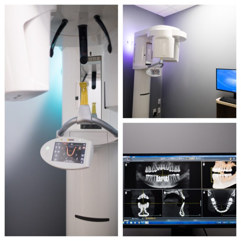 CBCT