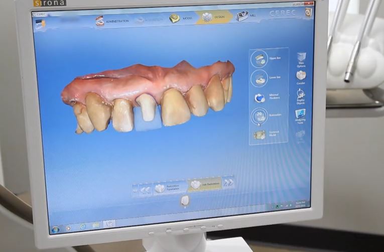 Crown 3D